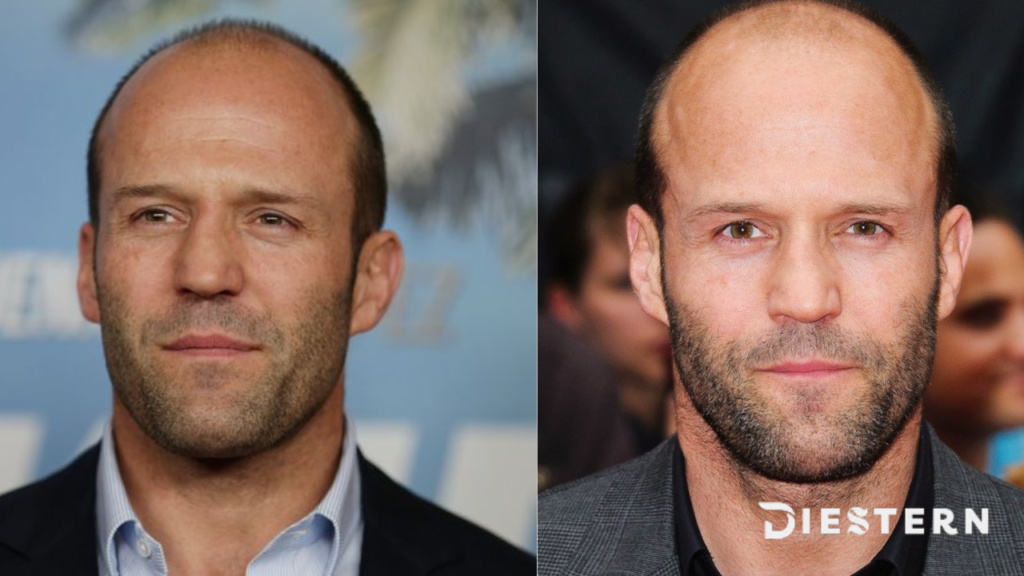 jason statham schlaganfall